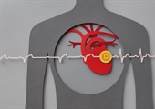 Study provides insights on ideal DOAC timing for patients with AFib post stroke