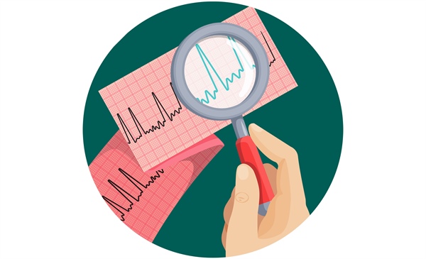 Analysis suggests preferred oral anticoagulant in patients with AFib and cirrhosis